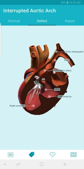Heartpedia - 3D-модели врожденных пороков сердца