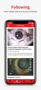 Eyetube, відео для офтальмологів