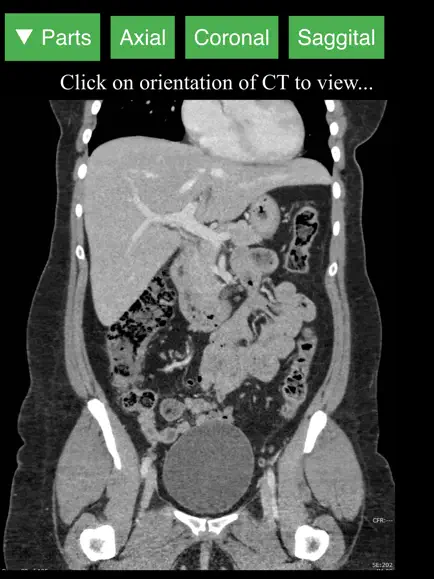 Radiology CT Anatomy - изучения анатомии человека на КТ-изображениях